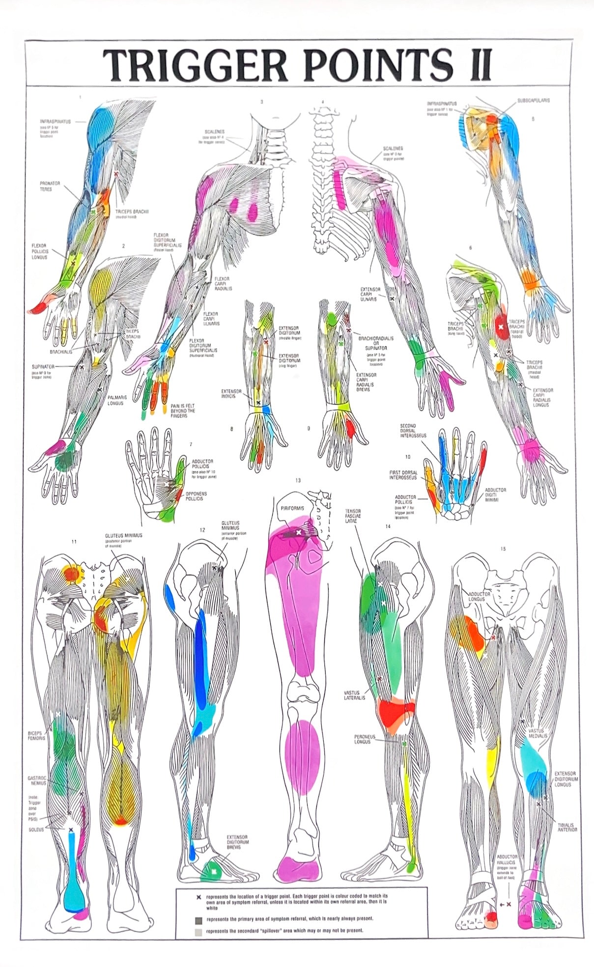 Trigger Point Game Trigger Points