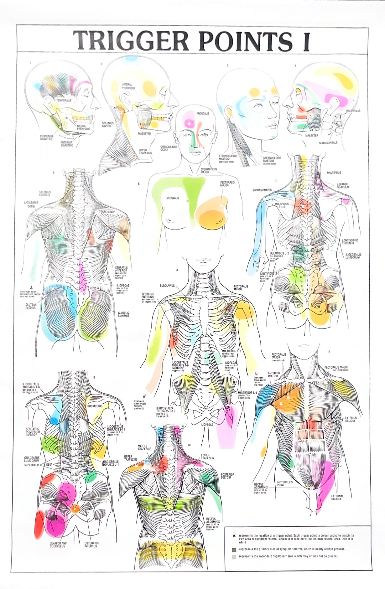 Trigger Point Game Trigger Points